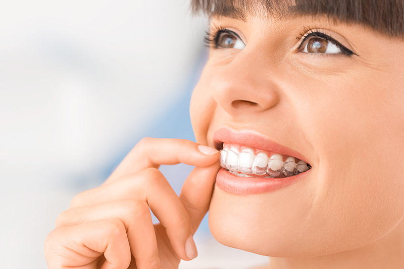 Invisalign in Leesburg